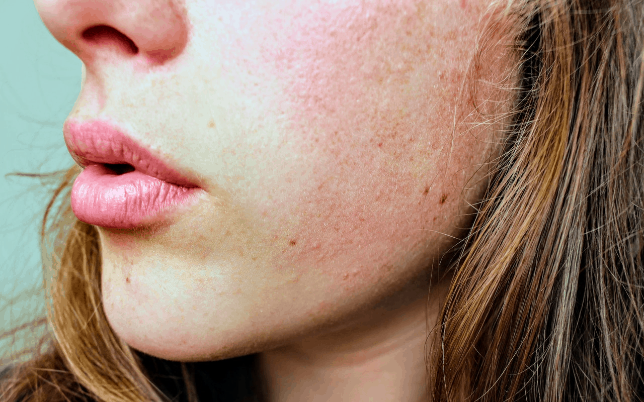 woman with dry skin functional medicine